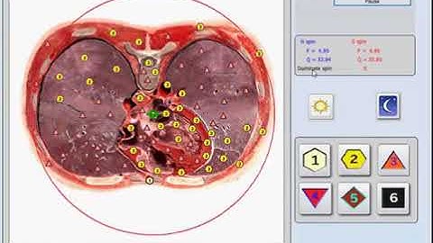 Non Linear System Health Analyzer (NLS)​