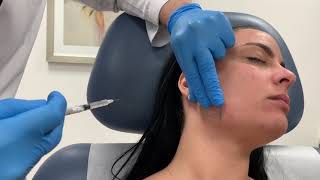 Dysport treatment for masseter muscle enlargement by Dr. Shaun Patel in Miami Treating Enlarged Masseter Muscles With Botox By Dr Shaun Patel
