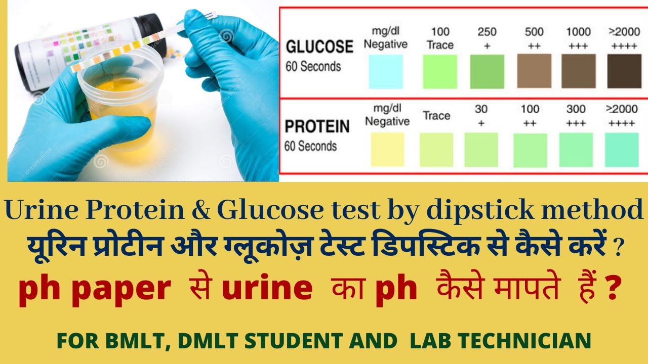 Urine protein test in hindi || Urine Glucose test by dipstick || urine