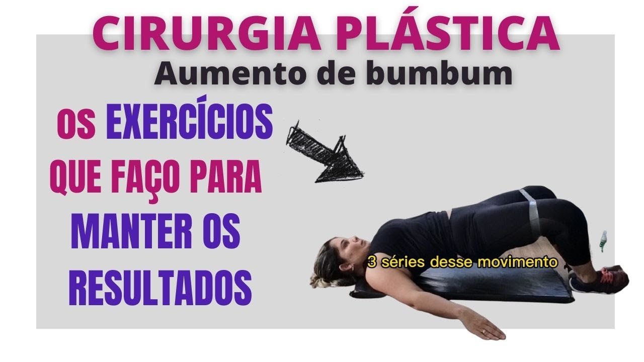 Exercícios para Lipedema! Aprenda e comece hoje mesmo! 