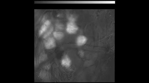 Odor representations in the brain