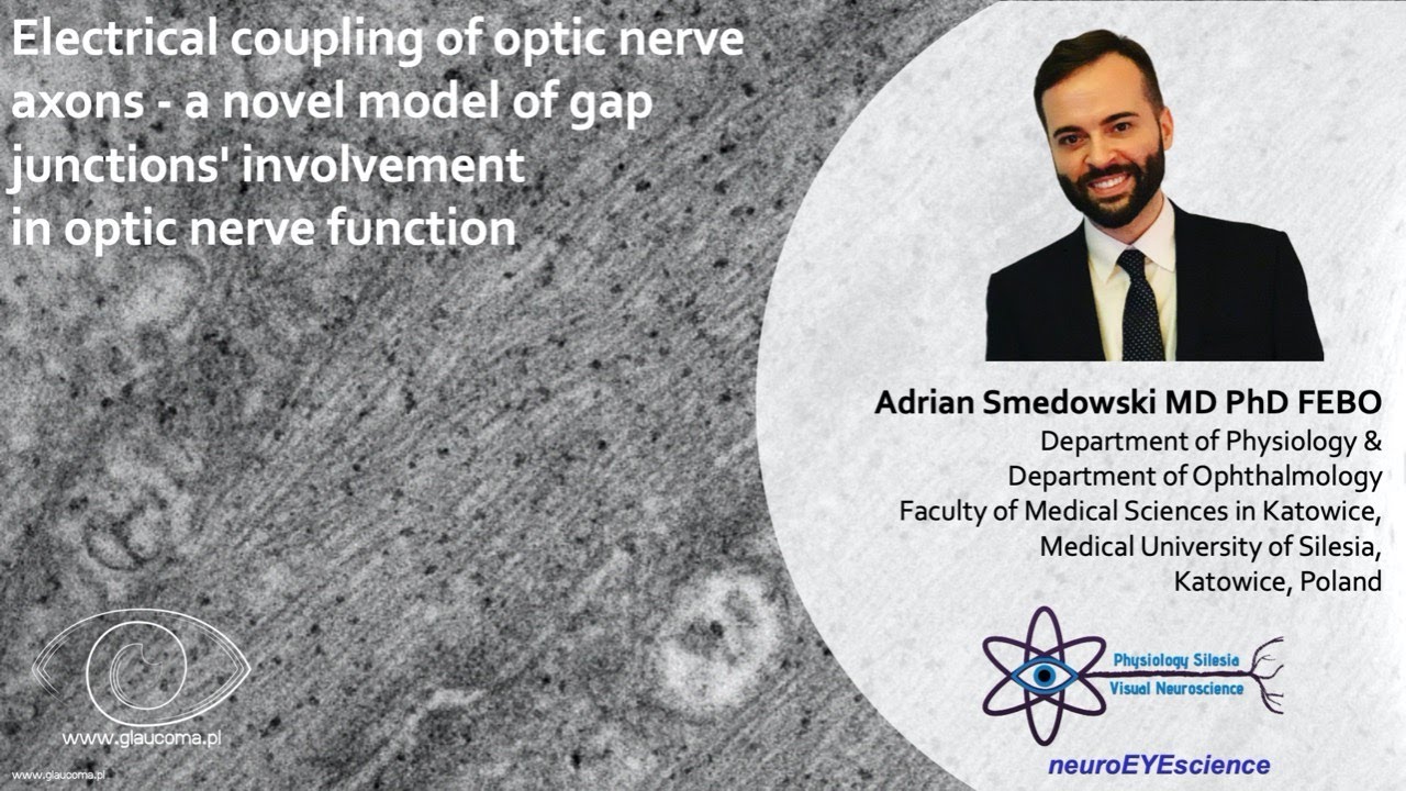Electrical coupling of optic nerve axons - a novel model of gap junctions' involvement in optic nerv