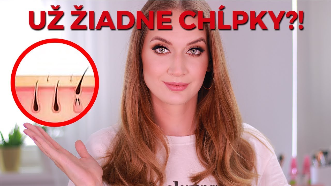 TRVALÁ EPILÁCIA: Moja skúsenosť