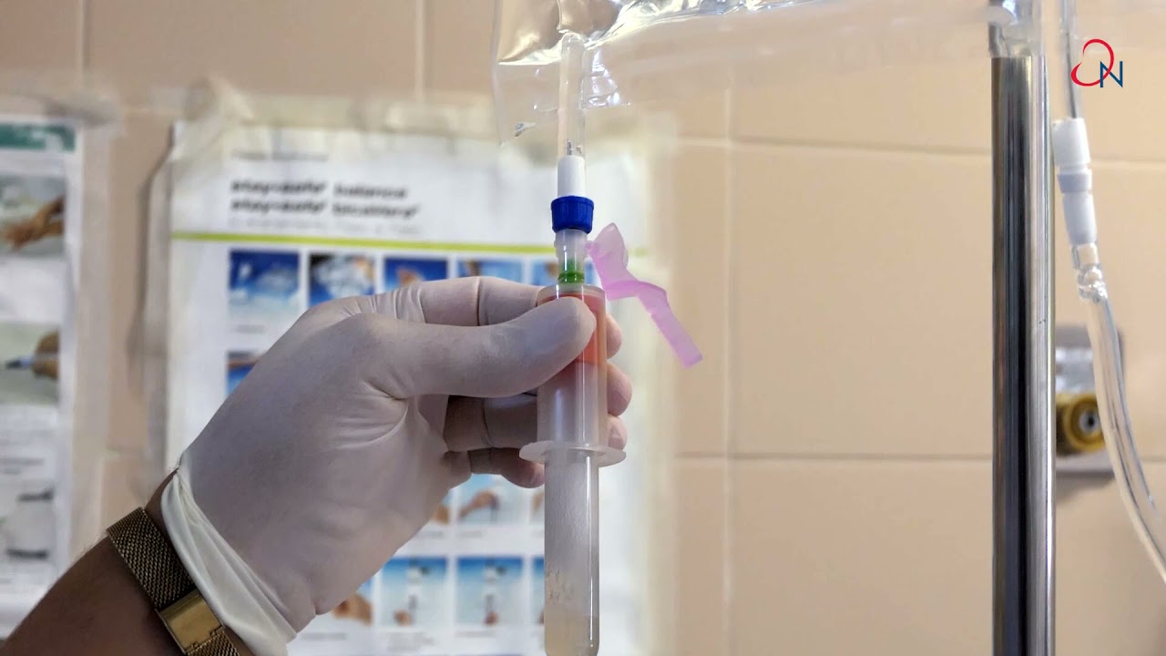 Test de equilibrio peritoneal (TEP) con drenaje total a la hora