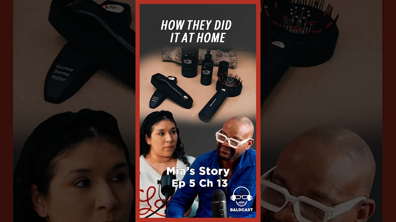 Ep 5 Ch 13: Mia's At Home Hair Loss Treatment Routine | Alopecia Totalis Journey