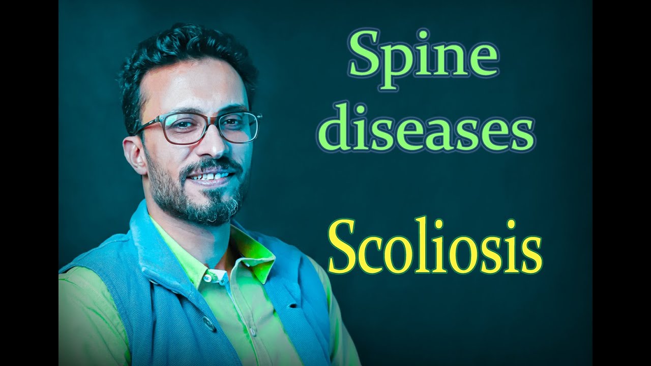 04 Spine diseases: Scoliosis
