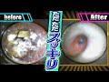 耳の中がスッキリ…耳掃除動画 ear wax removal
