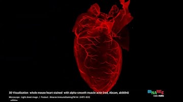 3D visualization of whole mouse heart stained with alpha-SMA