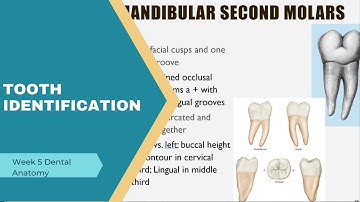 Tooth Identification