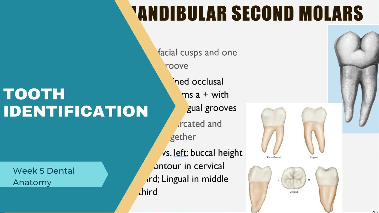 Tooth Identification