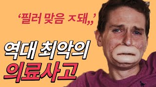 전 세계적으로 난리난 강남 유명 성형외과에서 은폐한 성형 수술