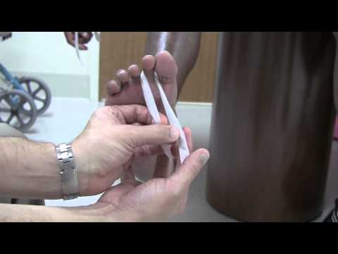 Strapping of Toes