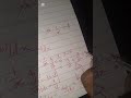 EPISODE 10. DERIVATIVE OF In x and e^x ( SPECIAL FUNCTIONS). CALCULUS 1 ( DIFFERENTIAL CALCULUS).🔥