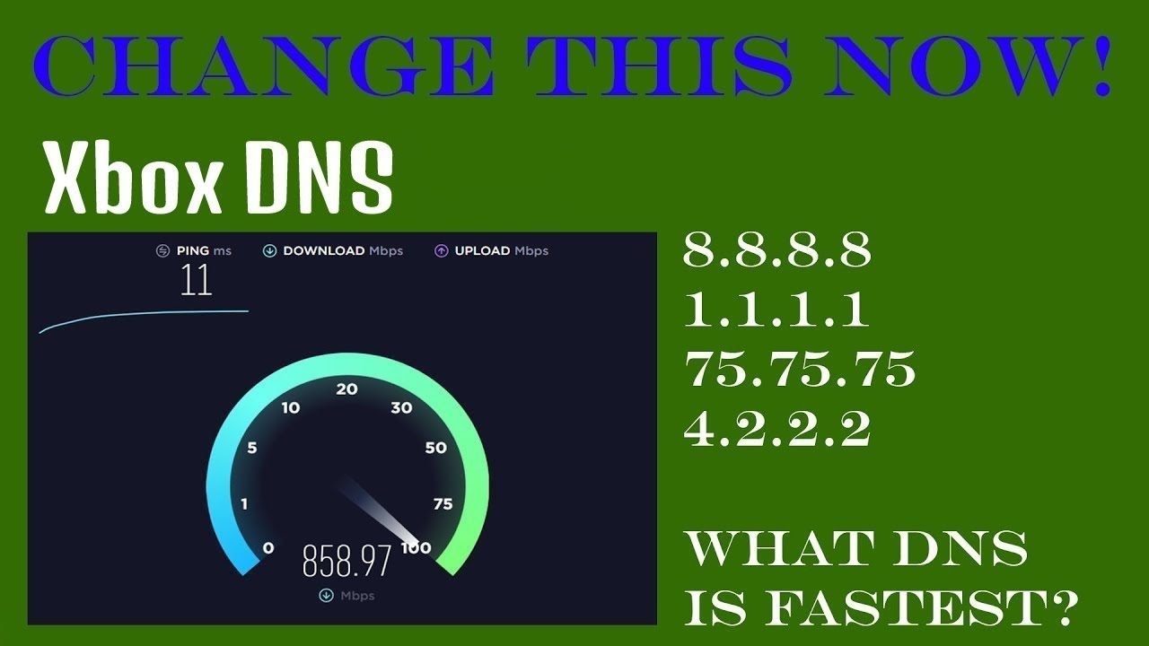 Your ping. ДНС иксбокс. ДНС Xbox one. DNS для Xbox. Xbox Series s ДНС.