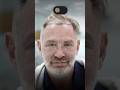 12-Month Hair Transplant Before &amp; After – Clinical Result by Heva Clinic #hairtransplant