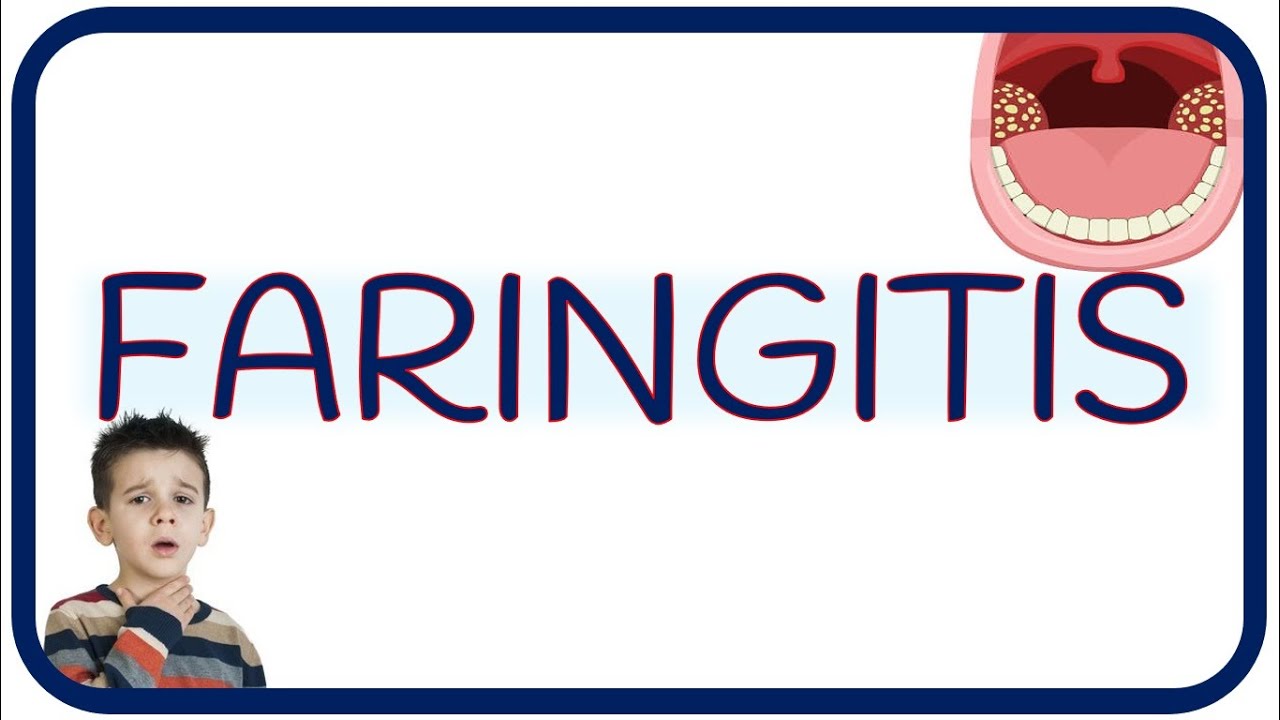 FARINGITIS - estreptocócica, viral, escarlatina, dolor y exudado