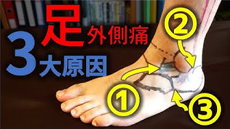 足の甲の痛み Youtube