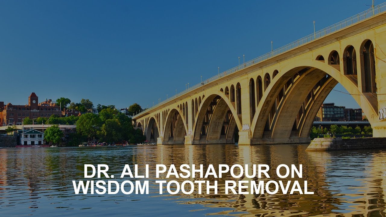 ⁣Wisdom Tooth Removal Washington DC - Pashapour Oral + Facial Surgery