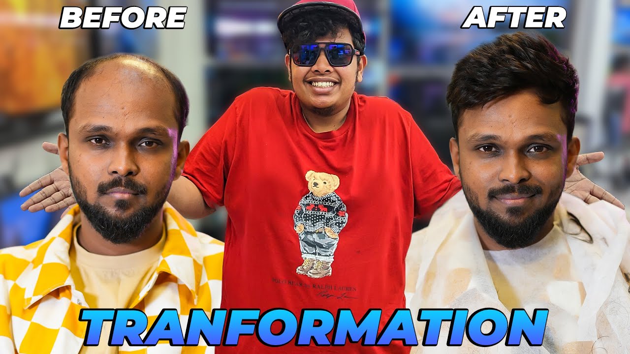 Hair Transformation 😱 | Dr Hair - Irfan's View