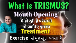Trismus: Treatment, Causes and Symptoms || Problem in mouth opening screenshot 5