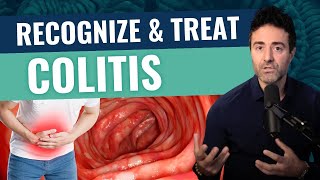 What Ulcerative Colitis Is & How You Can Treat It Effectively