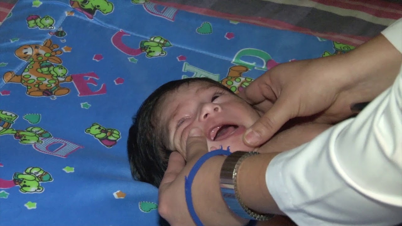 (24-05-18) Equipos Comunitarios de Salud Familiar, Ojos de Agua elton john