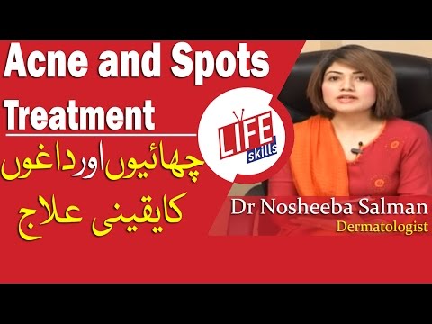 Acne and Spots Treatment by Dr Nosheeba Salman | Life Skills TV