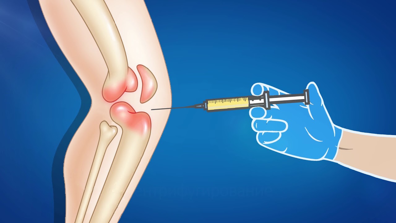Лечение болей в суставах. Боли в пояснице. Новая медицина - YouTube