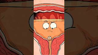 İdrarın Rahatsızlık Veren Idrar Taşlarını Nasıl Temizlediğini Gözlemle