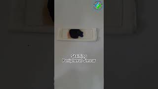 Blood Smear And Giemsa Staining  Staining  Hematology  How To  Do Giemsa Stain In Hematology