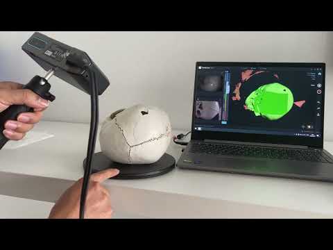 Scan and repair a broken human skull model by CR-Scan Otter