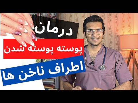 درمان پوسته پوسته شدن حاشیه و اطراف ناخن