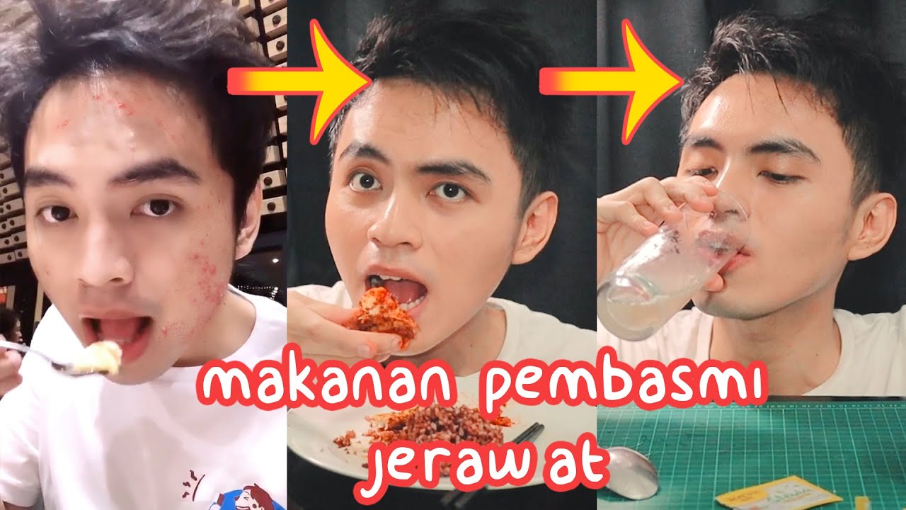 BASMI JERAWAT DENGAN MAKANAN RAHASIAKU INI! MUKBANG | PSK Episode 3
