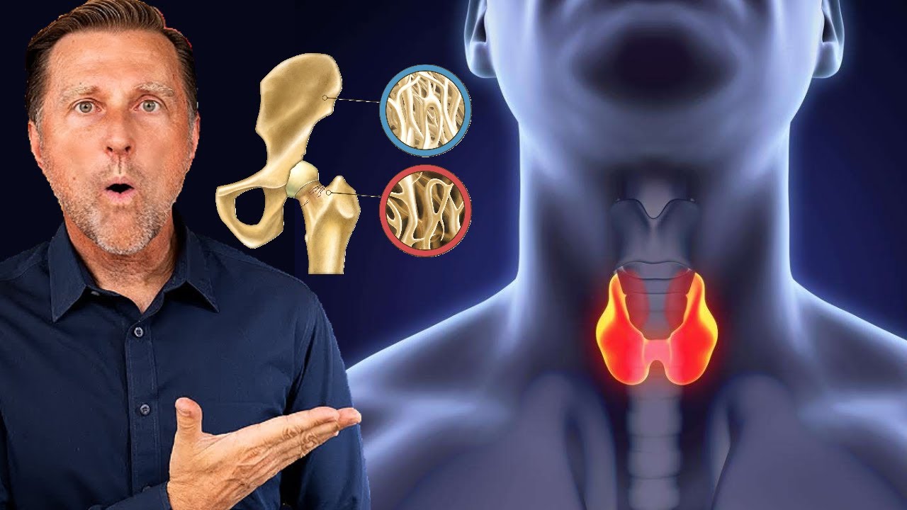 Tiroid Hormonu Tedavisi: Beklenmedik Riskler ve Uzun Vadeli Etkiler | Dr. Berg Türkçe