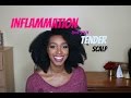 Tips for Tender scalp, Sore scalp, Inflamed scalp on Natural hair, How to treat