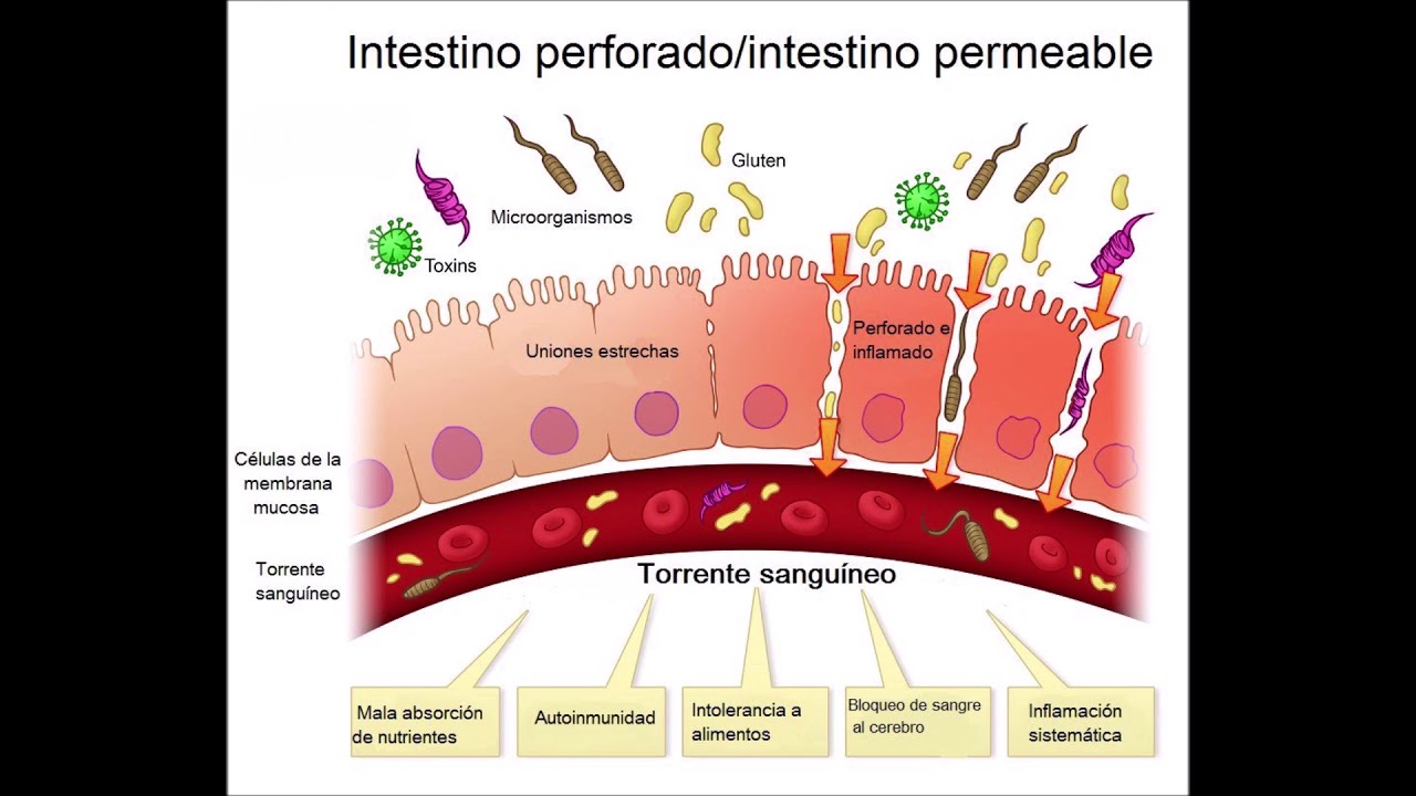 Permeabilidad intestinal dieta
