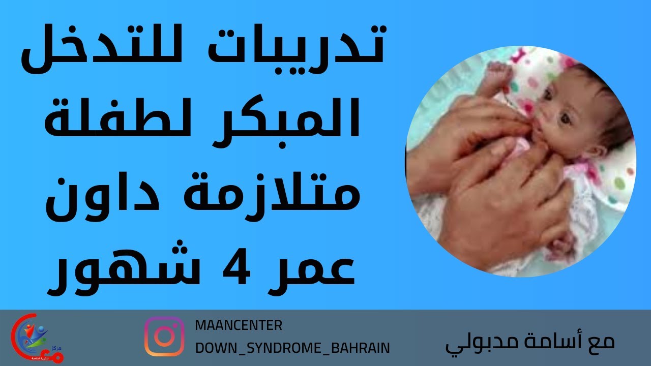 تدريبات للتدخل المبكر لطفلة متلازمة داون عمر 4 شهور مع سلسلة  من الارشادات الهامة | مع اسامة مدبولي