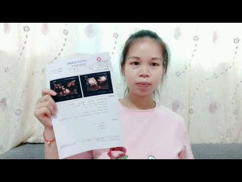 孕32周胎儿绕颈一周这可怎么办？是孕妈调皮了？还是胎宝宝调皮了