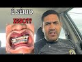 APARELHO POR ESTÉTICA é real?