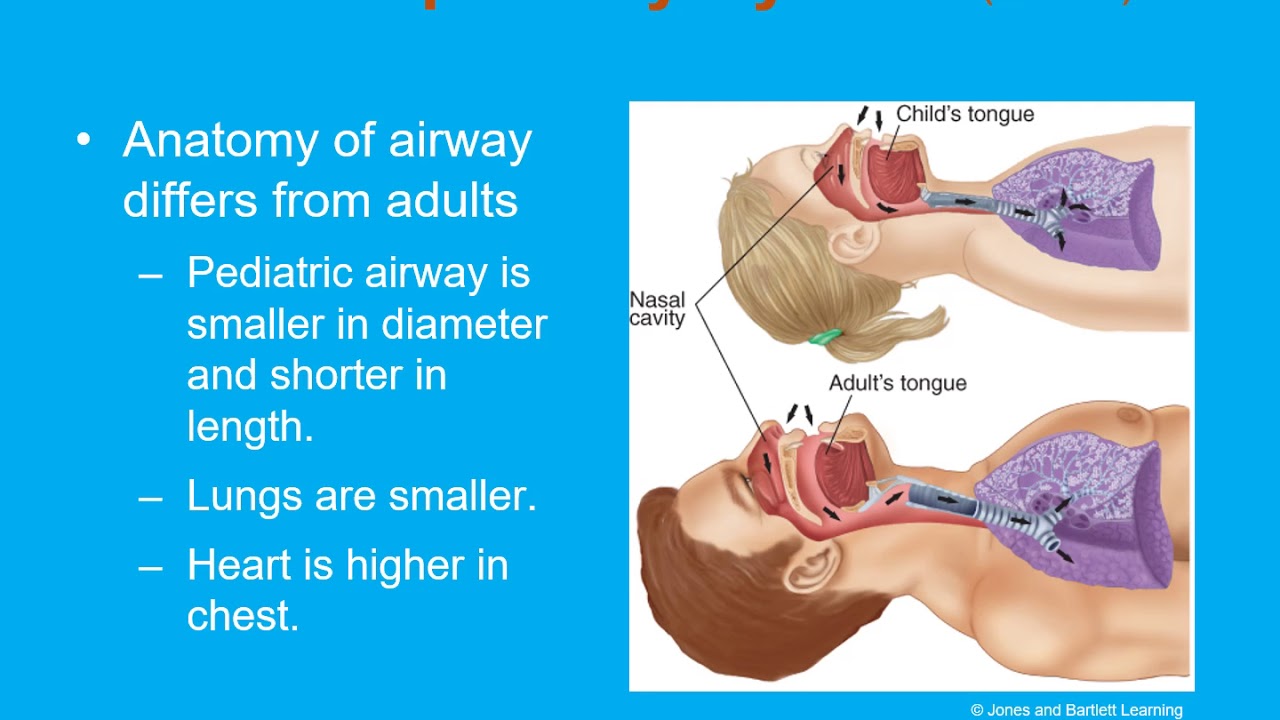 Chapter 34 Pediatric Emergencies
