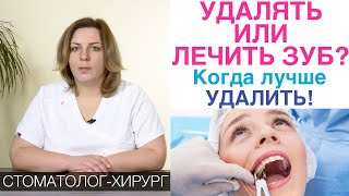 Удалять зуб или лечить зуб? Врач предлагает удалить зуб - когда надо удалить зуб, а когда лечить?