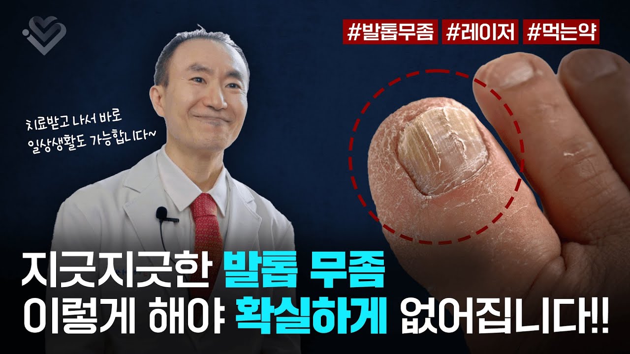 피부과 전문의가 알려주는 '발톱 무좀'에서 탈출하는 가장 확실한 방법!!_[아이러브 피부과] - YouTube