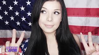 Blaire White   Before and After Transformations