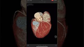 Visage Ease Ipad App Demo screenshot 1