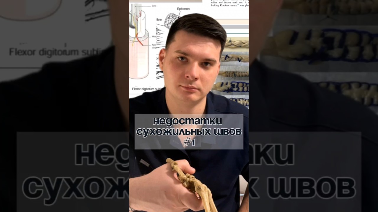 основные недостатки швов сухожилия 