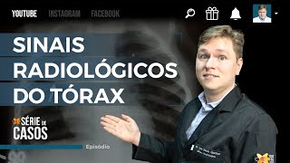 PRINCIPAIS SINAIS RADIOLÓGICOS DO TÓRAX (PARTE 1)