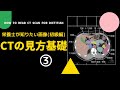 #43の③【栄養士が知りたい画像(初級編)_CTの見方基礎】How to Read CT scan for Dietitian