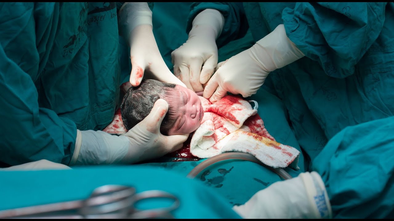 ✔️ Подвывих атланта - что это такое (у взрослых, у детей; симптомы и лечение)