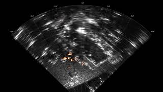 MMI-100 Imaging a Road with an Ambulance Passing Through