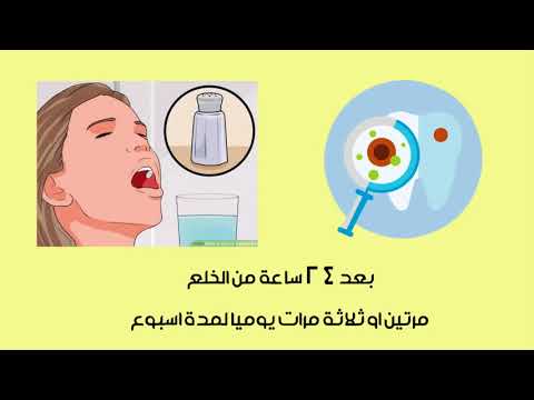 النصائح والإرشادات بعد خلع الأسنان